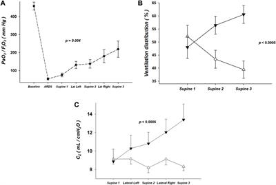 Real-time effects of lateral positioning on regional ventilation and perfusion in an experimental model of acute respiratory distress syndrome